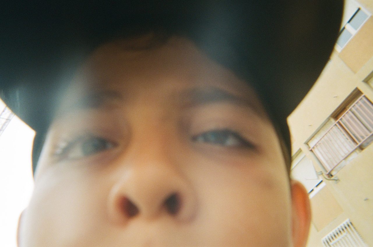 surprise